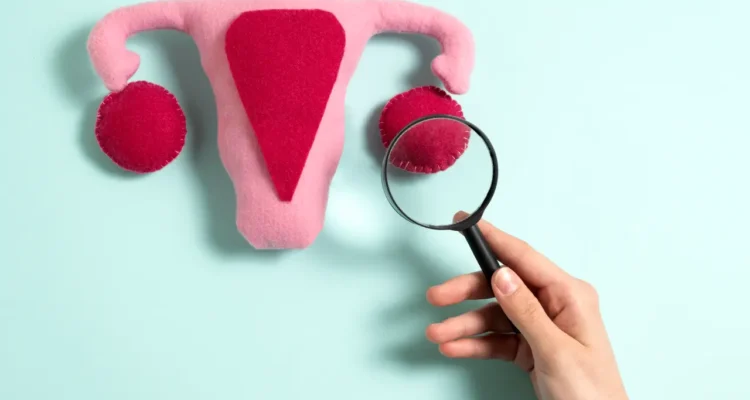 Healing PCOS Naturally