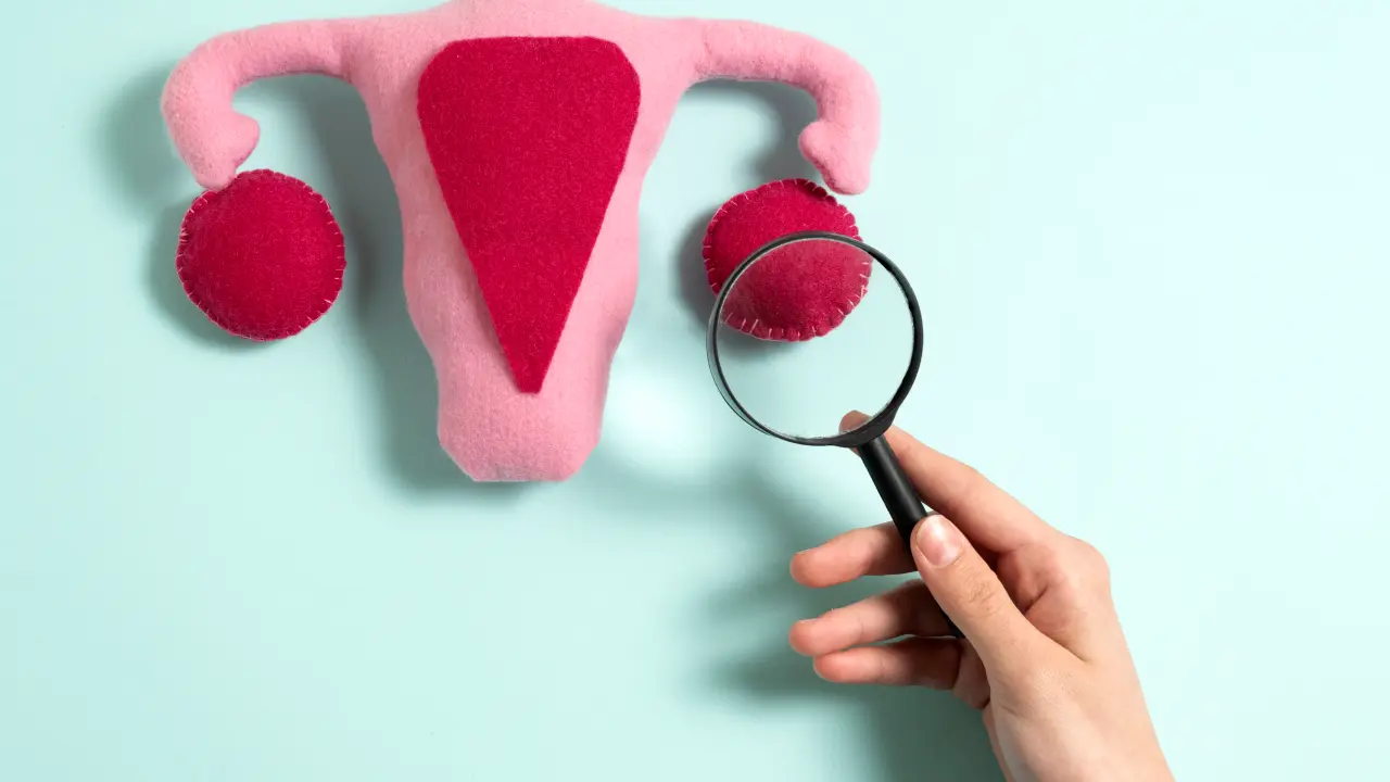 Healing PCOS Naturally